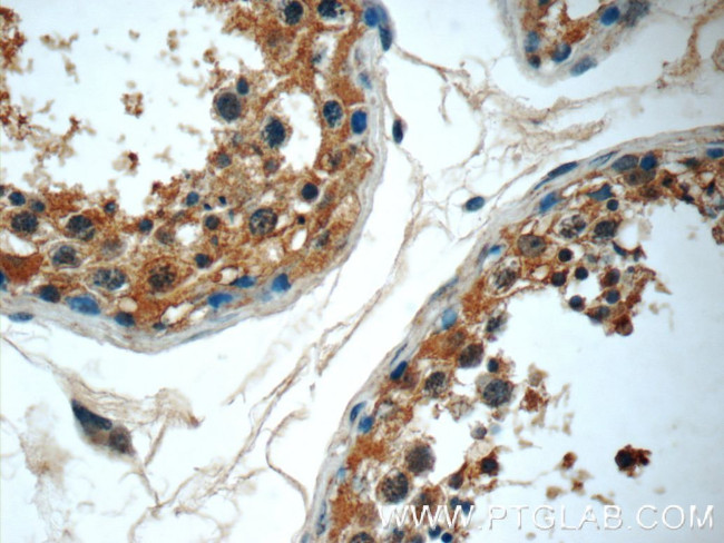 RPL39L Antibody in Immunohistochemistry (Paraffin) (IHC (P))