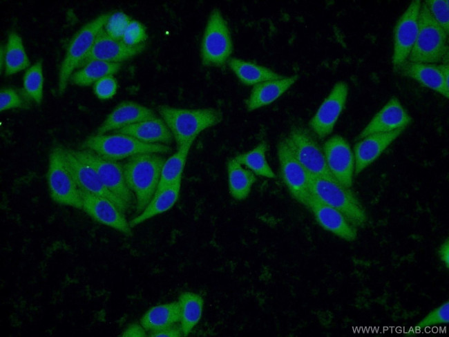 SCCPDH Antibody in Immunocytochemistry (ICC/IF)