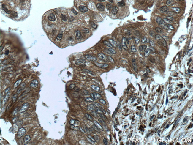 ME2 Antibody in Immunohistochemistry (Paraffin) (IHC (P))