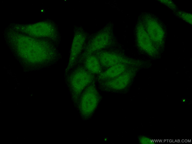 PRPF38A Antibody in Immunocytochemistry (ICC/IF)