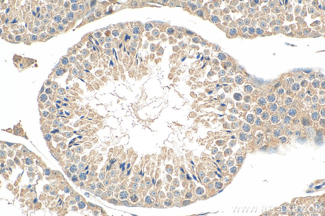 KIAA0182 Antibody in Immunohistochemistry (Paraffin) (IHC (P))