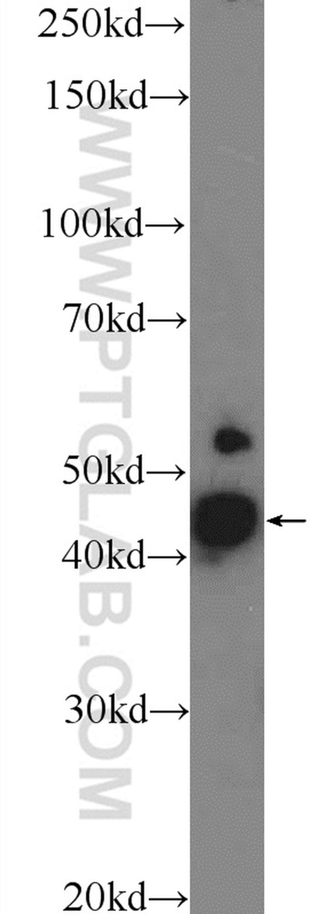MCUR1 Antibody in Western Blot (WB)