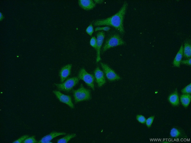 C6orf15 Antibody in Immunocytochemistry (ICC/IF)