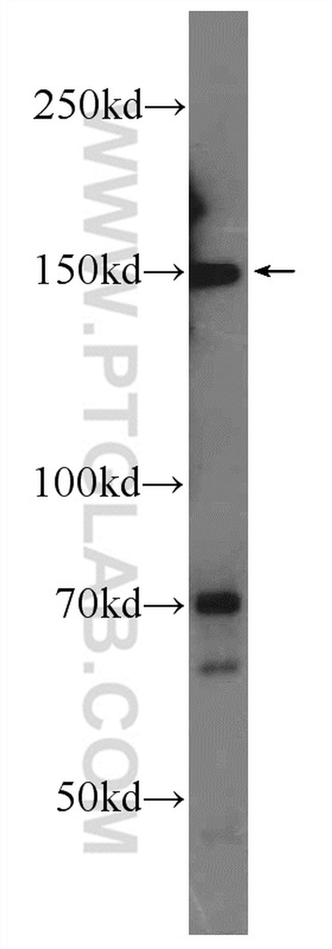 ATAD5 Antibody in Western Blot (WB)