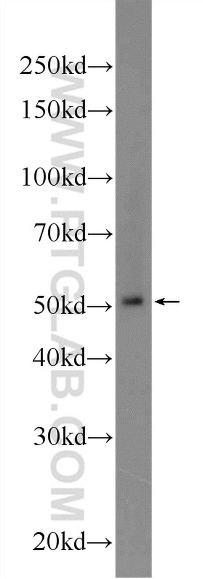 BTNL8 Antibody in Western Blot (WB)