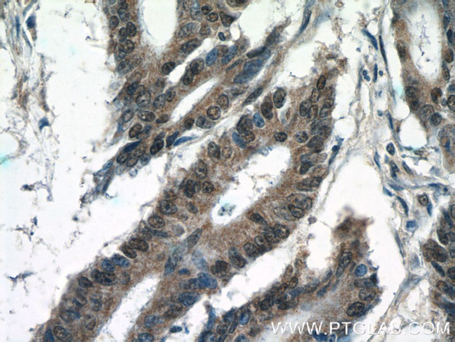 KIAA0087 Antibody in Immunohistochemistry (Paraffin) (IHC (P))