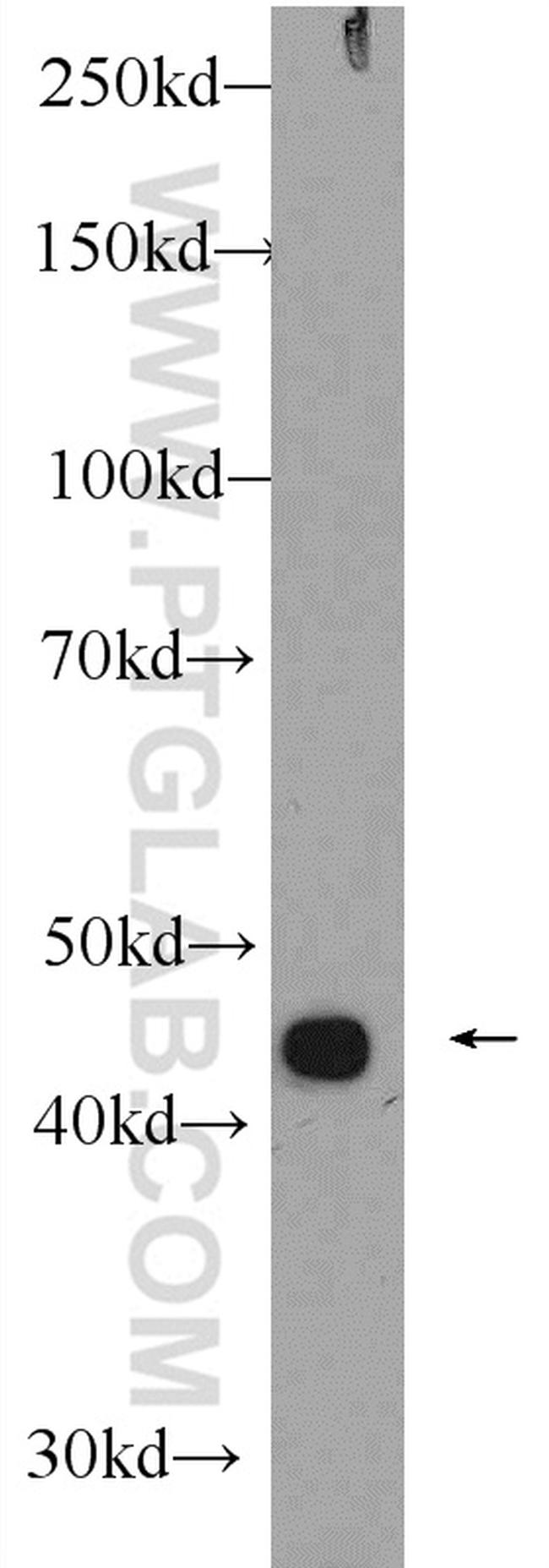 ZNF114 Antibody in Western Blot (WB)