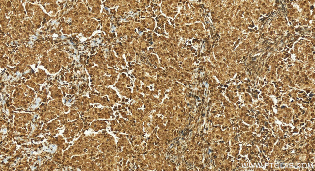 USP4 Antibody in Immunohistochemistry (Paraffin) (IHC (P))