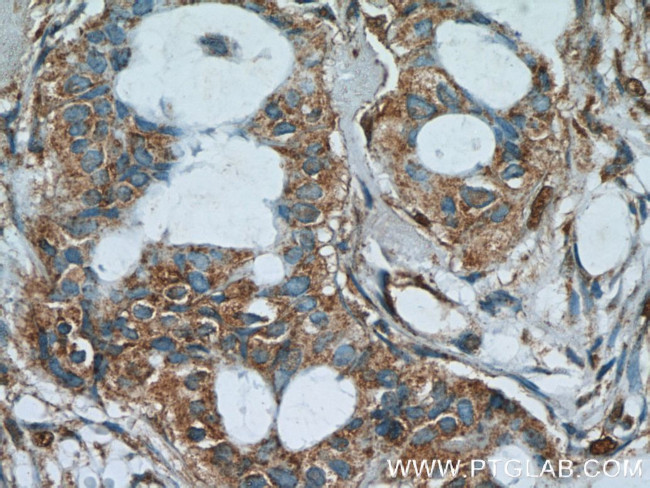 AKAP4 Antibody in Immunohistochemistry (Paraffin) (IHC (P))