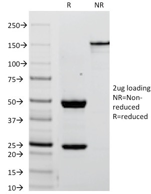 Alkaline Phosphatase (Placental)/PLAP (Germ Cell Tumor Marker) Antibody in SDS-PAGE (SDS-PAGE)