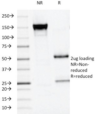 Alkaline Phosphatase (Placental)/PLAP (Germ Cell Tumor Marker) Antibody in SDS-PAGE (SDS-PAGE)