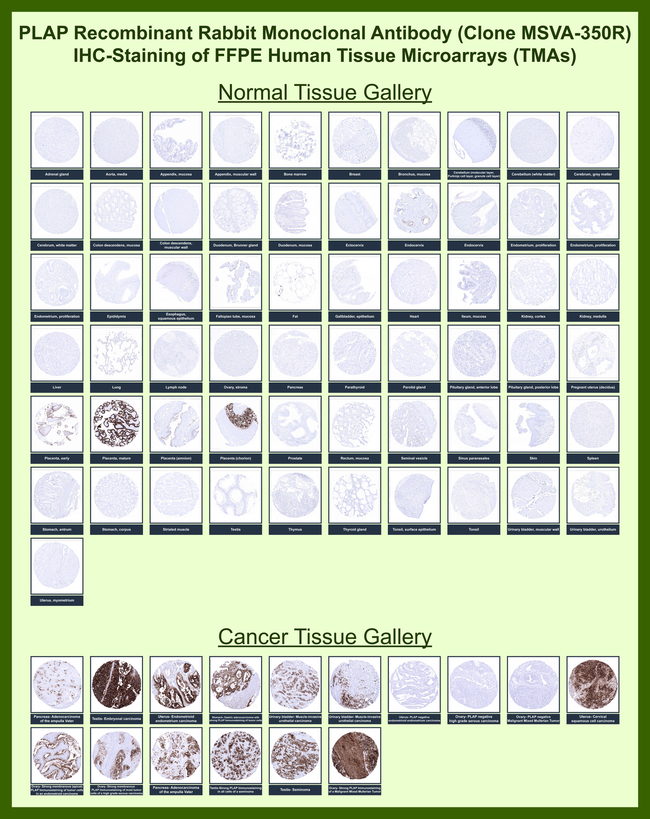 Alkaline Phosphatase (Placental)/PLAP (Germ Cell Tumor Marker) Antibody in Immunohistochemistry (Paraffin) (IHC (P))