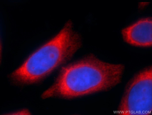 RPL22 Antibody in Immunocytochemistry (ICC/IF)