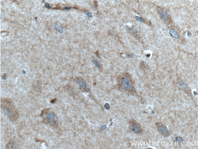 GRIA1 Antibody in Immunohistochemistry (Paraffin) (IHC (P))