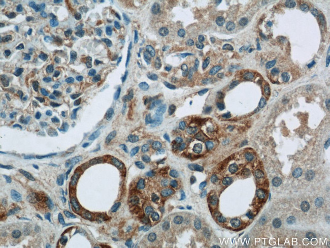PIPPIN Antibody in Immunohistochemistry (Paraffin) (IHC (P))