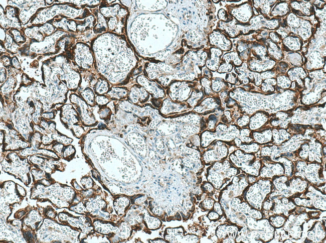 hCG alpha Antibody in Immunohistochemistry (Paraffin) (IHC (P))