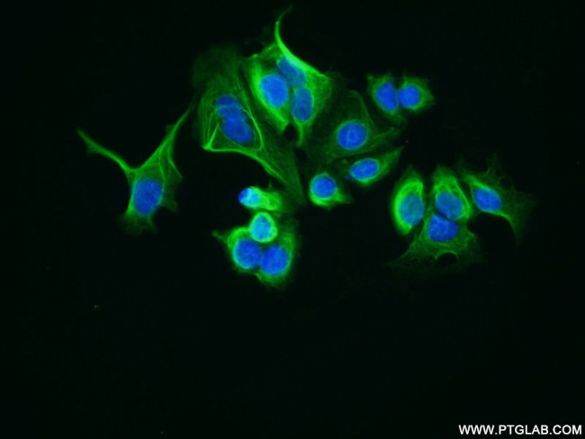 LRCH1 Antibody in Immunocytochemistry (ICC/IF)