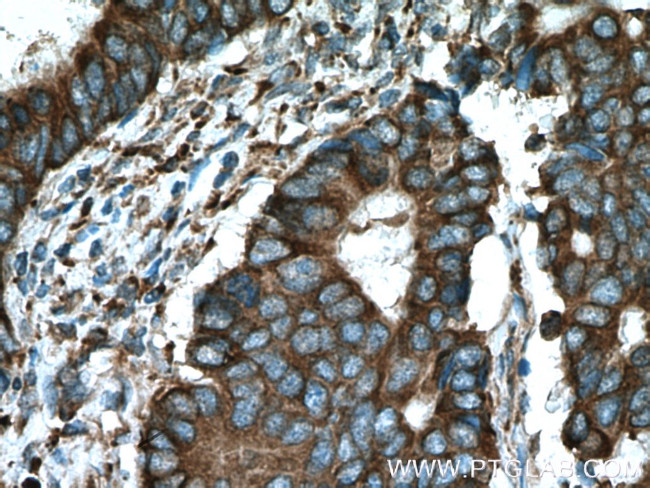C8orf48 Antibody in Immunohistochemistry (Paraffin) (IHC (P))