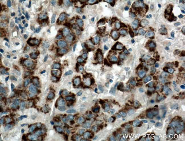 DEC1 Antibody in Immunohistochemistry (Paraffin) (IHC (P))