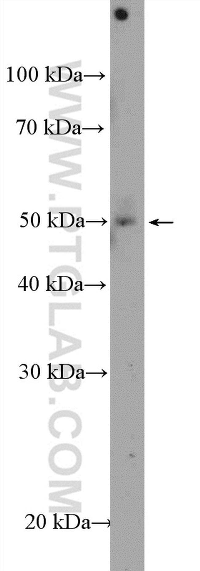 ZNF586 Antibody in Western Blot (WB)
