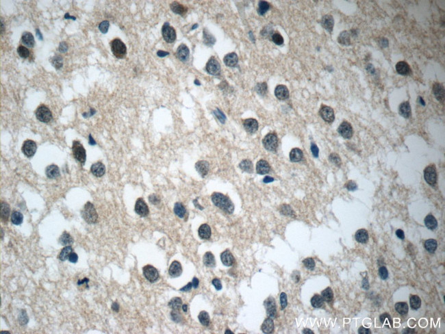 C21orf58 Antibody in Immunohistochemistry (Paraffin) (IHC (P))