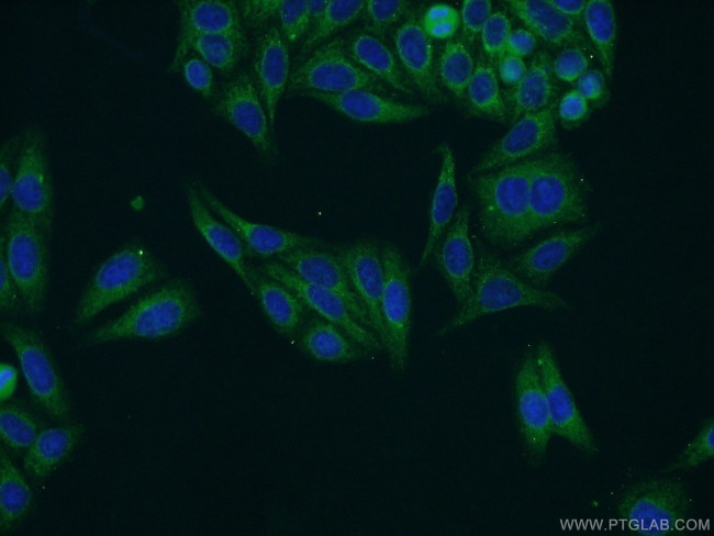 NWD1 Antibody in Immunocytochemistry (ICC/IF)