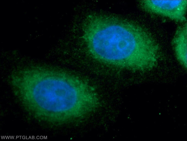 ANKRD49 Antibody in Immunocytochemistry (ICC/IF)