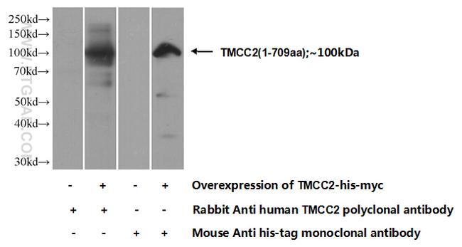 TMCC2 Antibody in Western Blot (WB)