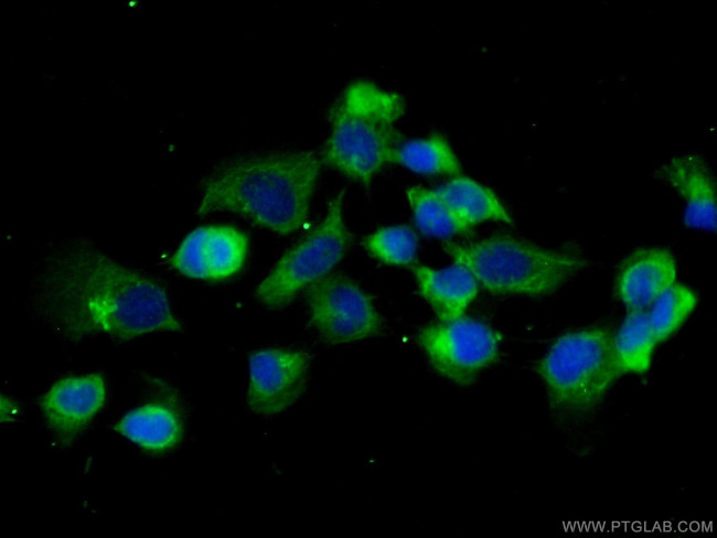 CAPZB Antibody in Immunocytochemistry (ICC/IF)