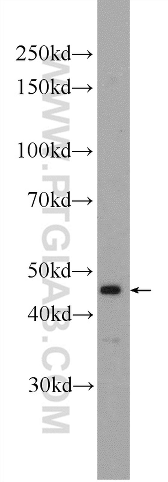 HOXA2 Antibody in Western Blot (WB)