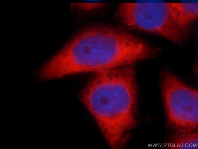 LPP Antibody in Immunocytochemistry (ICC/IF)