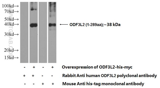ODF3L2 Antibody in Western Blot (WB)