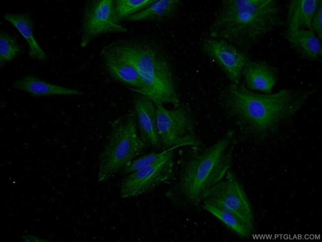 IDO2 Antibody in Immunocytochemistry (ICC/IF)