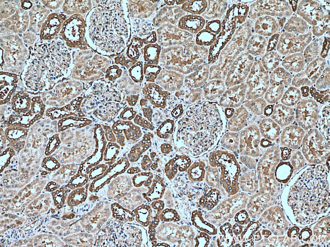 CAPNS1 Antibody in Immunohistochemistry (Paraffin) (IHC (P))