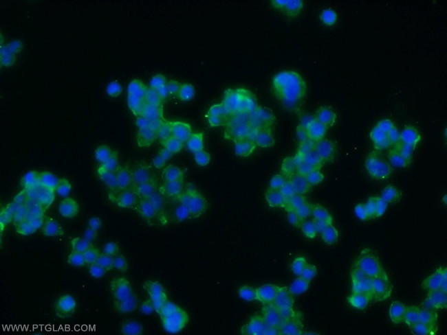 ARRDC3 Antibody in Immunocytochemistry (ICC/IF)