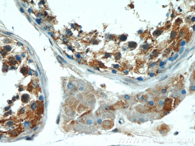 KLHL15 Antibody in Immunohistochemistry (Paraffin) (IHC (P))