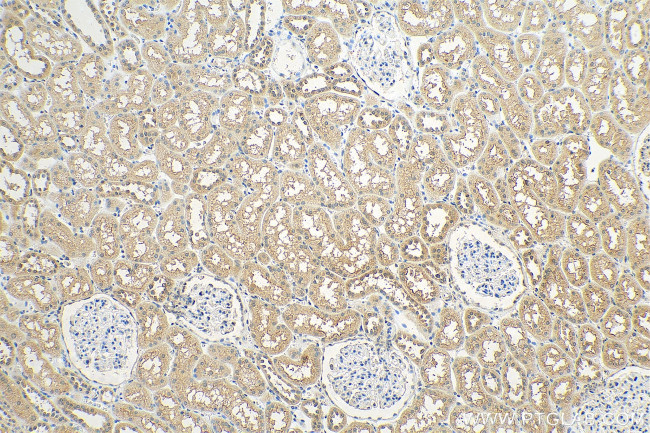 OTUD4 Antibody in Immunohistochemistry (Paraffin) (IHC (P))