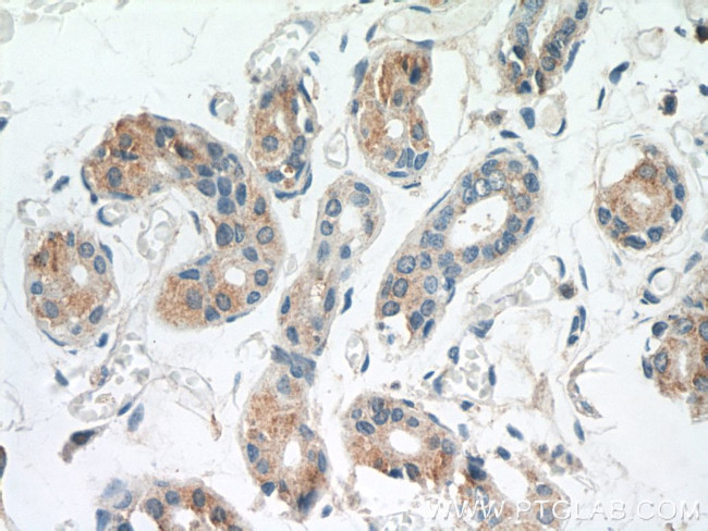 TGM5 Antibody in Immunohistochemistry (Paraffin) (IHC (P))
