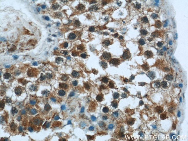 DNAH14 Antibody in Immunohistochemistry (Paraffin) (IHC (P))