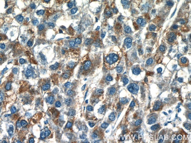 GDPD2 Antibody in Immunohistochemistry (Paraffin) (IHC (P))