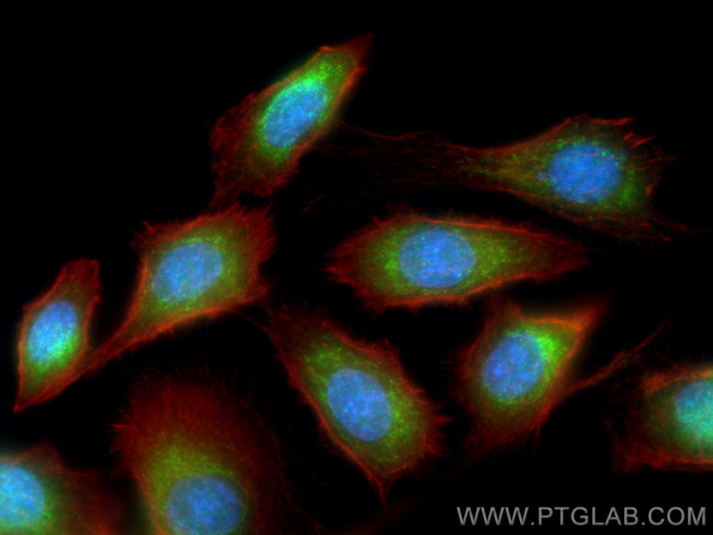 TMEM134 Antibody in Immunocytochemistry (ICC/IF)