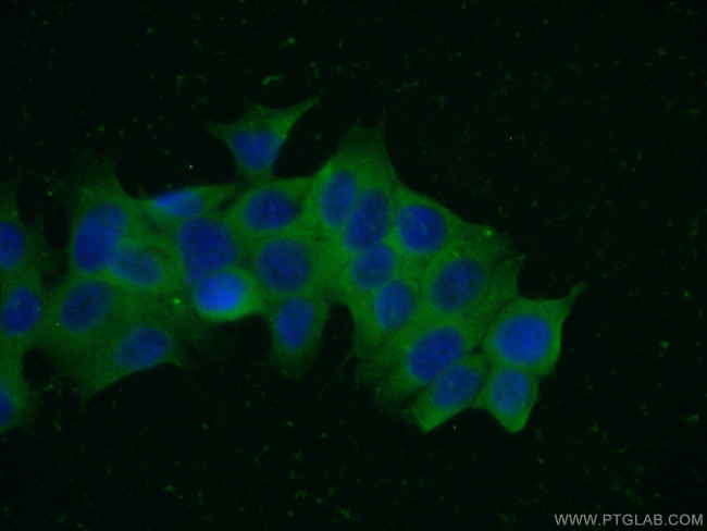 PGP Antibody in Immunocytochemistry (ICC/IF)