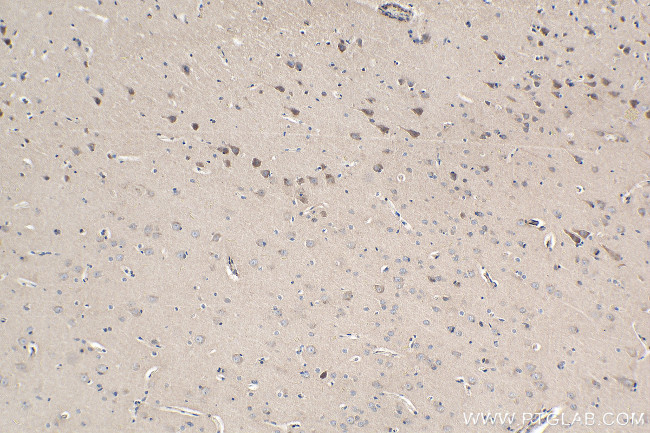 PCDH9 Antibody in Immunohistochemistry (Paraffin) (IHC (P))