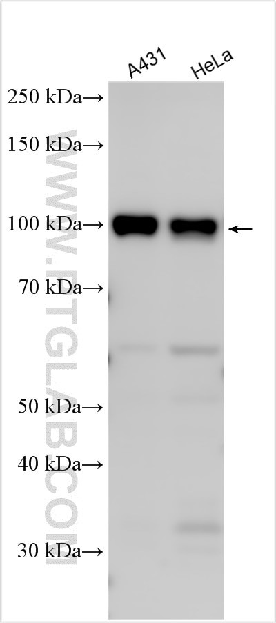 IGFN1 Antibody in Western Blot (WB)