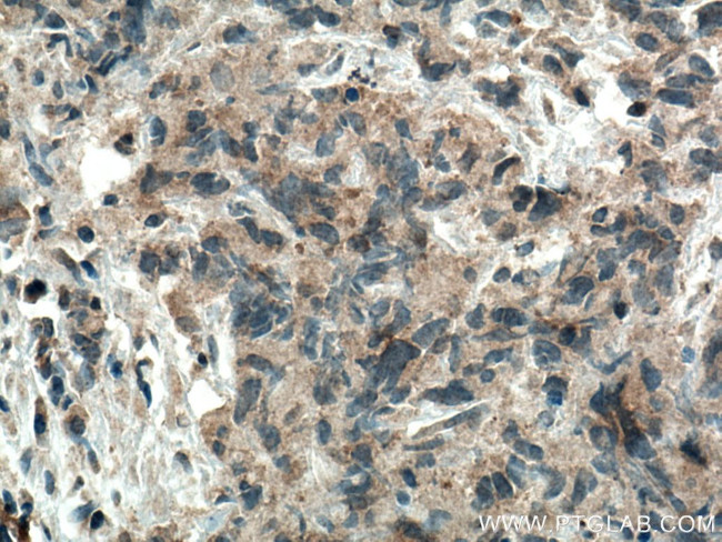 WFDC12 Antibody in Immunohistochemistry (Paraffin) (IHC (P))