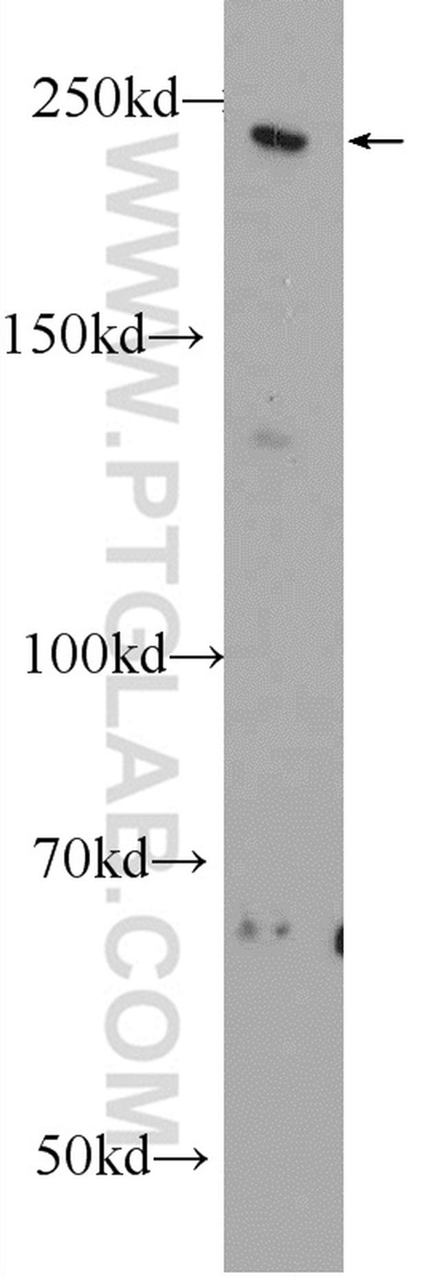 MYO16 Antibody in Western Blot (WB)