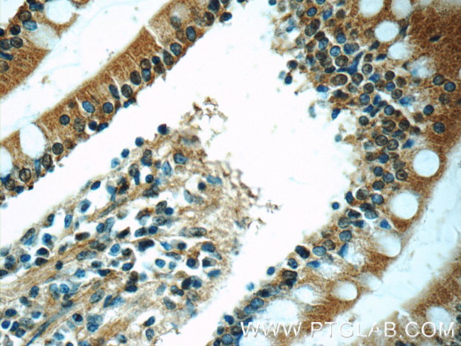 MGAT4A Antibody in Immunohistochemistry (Paraffin) (IHC (P))