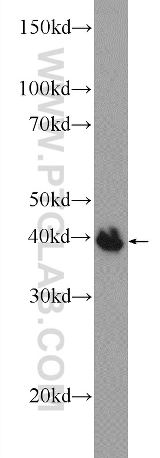 POU3F4 Antibody in Western Blot (WB)