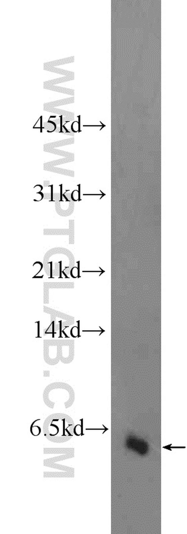 GALP Antibody in Western Blot (WB)