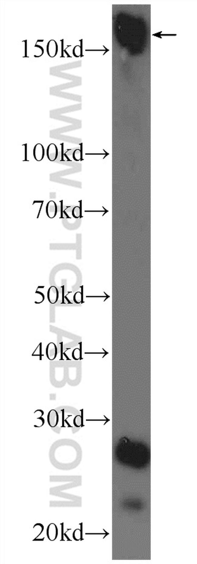 UHRF1BP1L Antibody in Western Blot (WB)